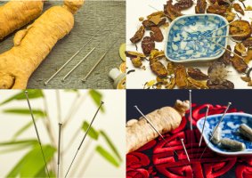 Acupuncture & Chinese Herbs